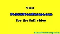 Reproducir Nervus facialis devoto adquiriendo nervus facialis cumstroke